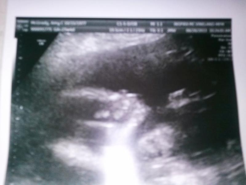 Baby Boy - 23weeks 3days.jpg